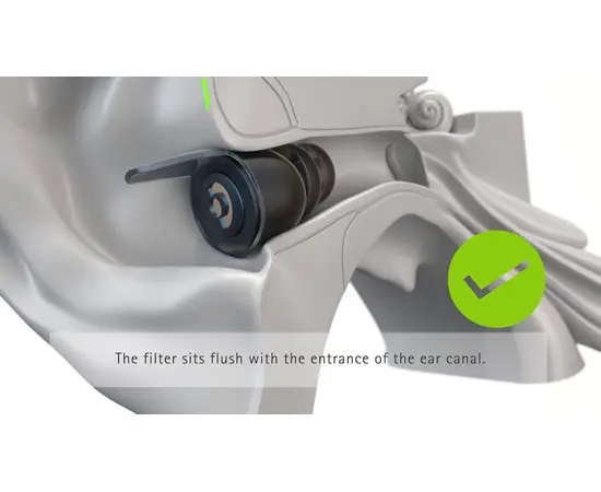 Phonak Serenity Choice Pro work